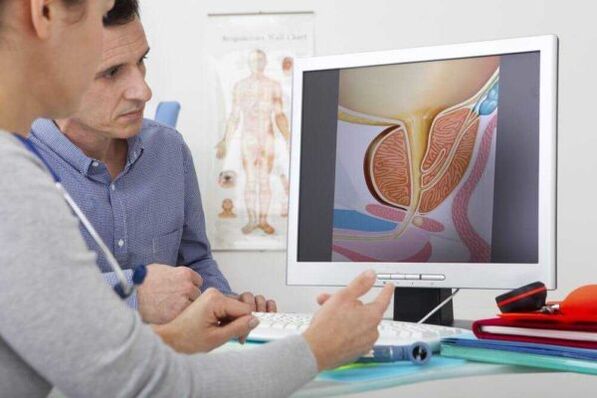 The doctor consults the patient in the case of prostatitis