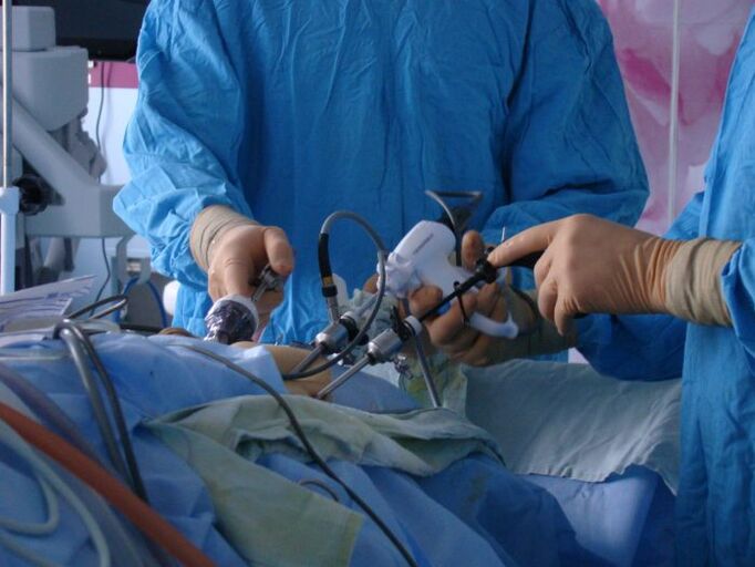 Surgical treatment of prostatitis