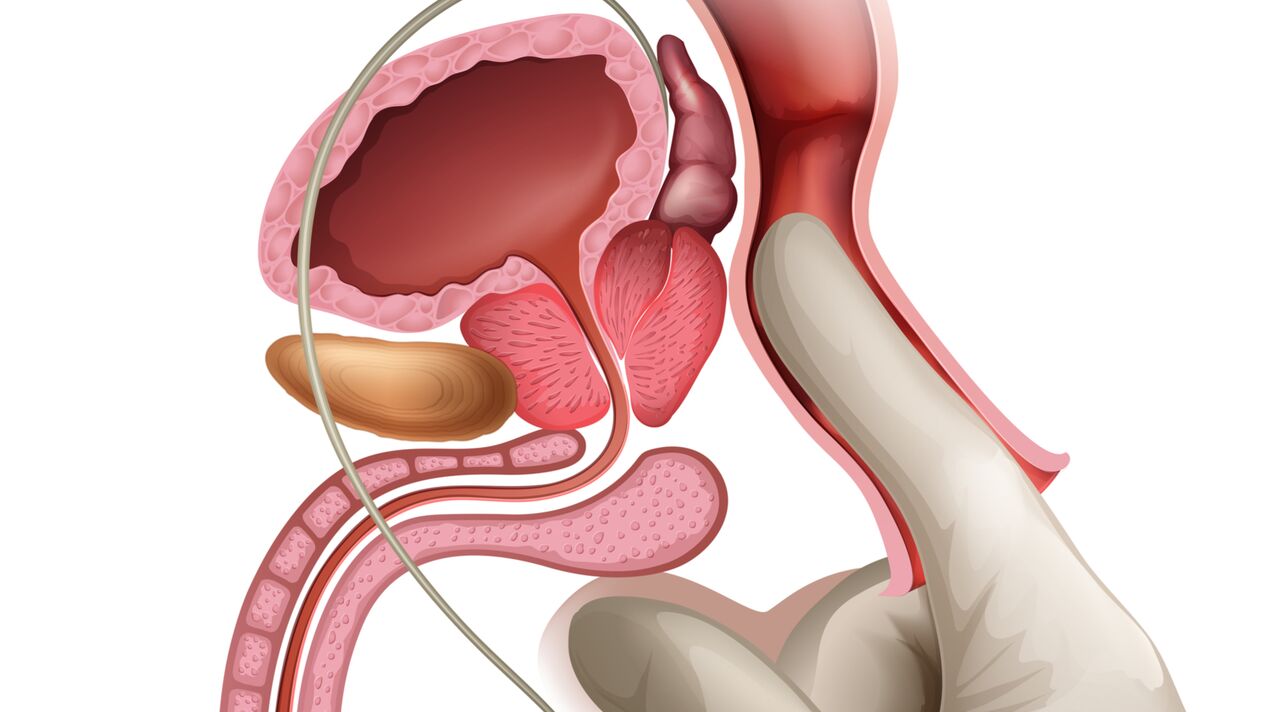 Prostate massage is an effective method in the treatment of congestive prostatitis