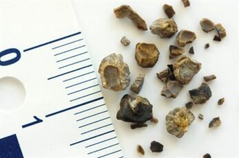 Stone